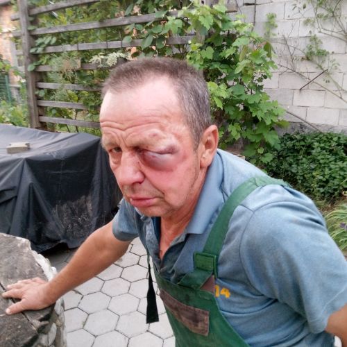 [Ekskluzivno] Takole so Strojanovi včeraj brutalno pretepli ljubljanskega kmeta in mu zlomili ličnico