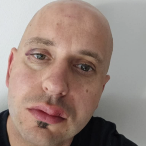 Roma v Ribnici pretepla župana Sama Pogorelca in policistko