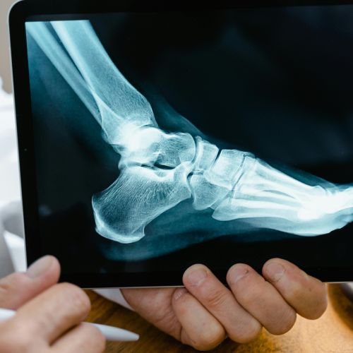 Leto dni čakanja na operacijo kolena? Luksuz, ki ga kmalu več ne bo