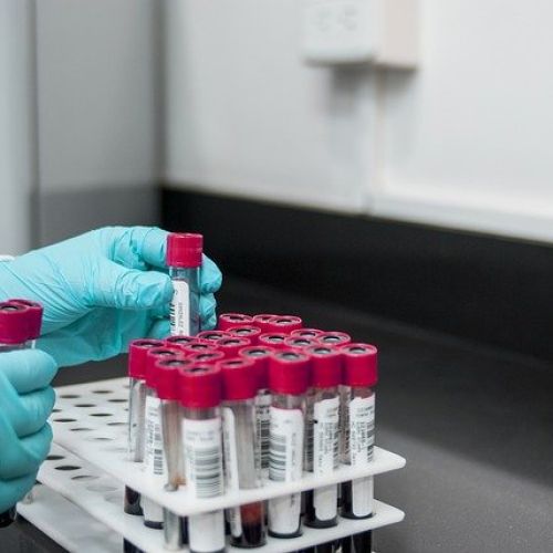 testiranje_laboratorij.jpg