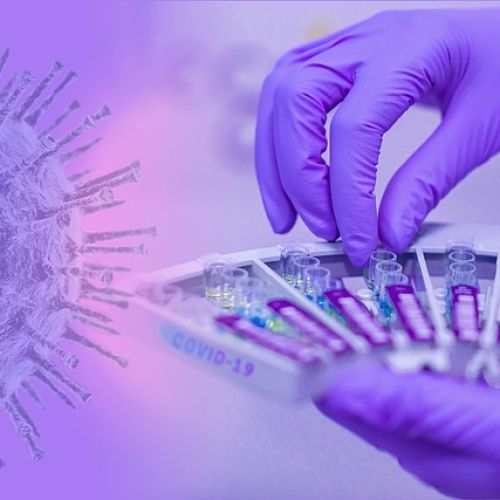virus_laboratorij.jpg